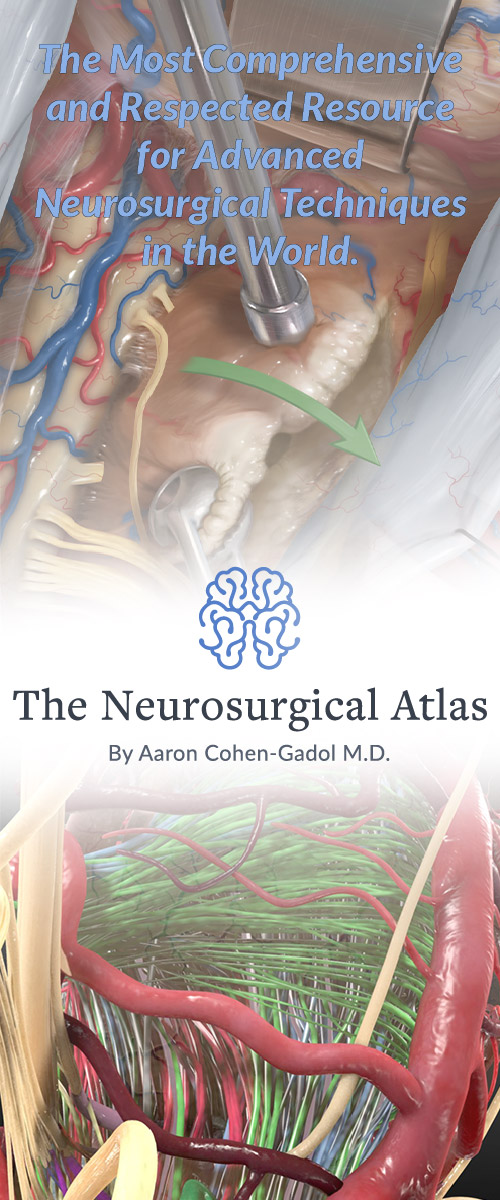 世界上先進的神經外科技術最全麵，最受尊敬的資源。